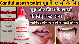 Clotrimazole Mouth Paint How To Apply  Candid Mouth Paint Use Said Effect In Hindi  Medical Wala [upl. by Jeff]