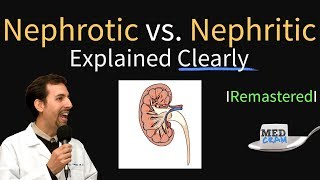 Nephrotic vs Nephritic Syndrome Proteinuria Hematuria Casts [upl. by Alrad]