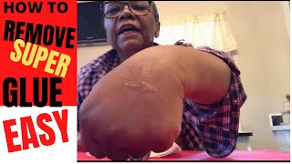 EASY WAY TO REMOVE GORILLA SUPER GLUE OFF SKIN [upl. by Kezer]