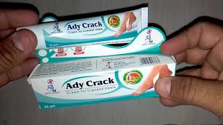 Ady Crack Cream for Cracked Heels review in Hindi [upl. by Snodgrass]