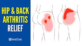 How to QUICKLY Relieve Hip and Back Arthritis Pain [upl. by Oibaf]