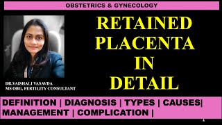 Retained Placenta in detail  DrVaishali Vasavda [upl. by Annenn744]