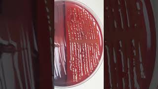 Identification of LactoseFermenting Bacteria on CLED Agar in Urine Culture [upl. by Thea]