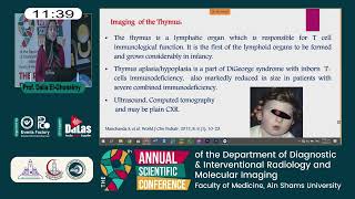 Phenotypic clues to inborn errors of immunity [upl. by Lamb330]