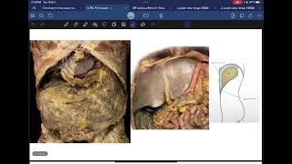 Anatomy L6 C1 The Peritoneum P1صوت الدكتور واطي نتفه اليوم، عشان ما كان في مايك بالقاعه [upl. by Hsejar808]