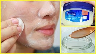 3 Days Overnight Pimples Treatment  Worlds best Pimple Treatment Method [upl. by Melone]