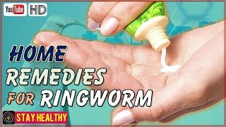 9 Home Remedies For Ringworm In Humans [upl. by Anissa]