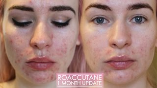 1 MONTH ROACCUTANE UPDATE  Side effects amp my skin now [upl. by Suinotna]