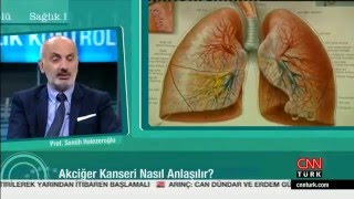 Akciğer Kanseri Cerrahi Tedavisi  CNN Turk [upl. by Thorma]