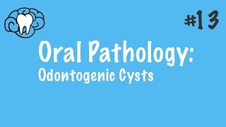 Oral Pathology  Odontogenic Cysts  INBDE ADAT [upl. by Porty]