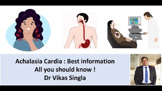 Achalasia cardia  Symptoms causes diagnosis treatment in Hindi Dr Vikas Sing [upl. by Ahseid]