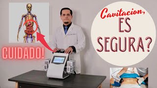 Es Segura la Cavitacion [upl. by Lenoel17]