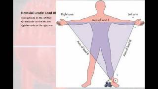 12 Lead Interpretation Part 1 Introduction to the 12 Lead EKG [upl. by Ahsinwad]