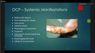 Ocular Cicatricial Pemphigoid David S Chu [upl. by Candide]