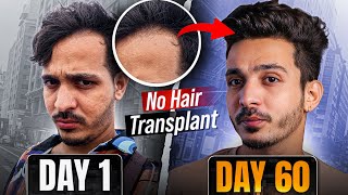 How I Reversed My Hair Loss Kaash yeh pehele pata hota 😔 [upl. by Ahders]