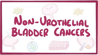 Nonurothelial cell bladder cancers  causes symptoms diagnosis treatment pathology [upl. by Crowley949]