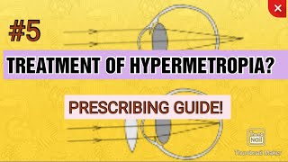 5 TREATMENT OF HYPERMETROPIA  Principles of hypermetropic correction  AAO guidelines [upl. by Pol]