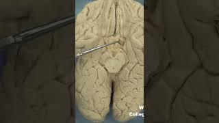 Parahippocampal gyrus uncusanatomyneuroanatomy cerebrumbraincortextemporallobelimbicsystem [upl. by Dougie]