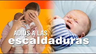 Las escaldaduras en los bebés  síntomas causas y soluciones [upl. by Lait]