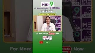 Urticaria Causes amp Symptoms in Telugu  skinallergies skinrashes urticaria homeopathy ytshorts [upl. by Nevad]