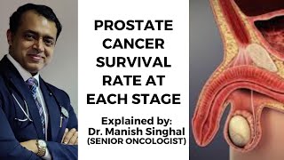 What is the Advanced Prostate Cancer Survival Rate  Explained by Dr Manish Singhal [upl. by Alyek154]