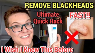 REMOVE SEBACEOUS FILAMENTS FAST  Blackhead Removal With La RochePosay Cicaplast Baume [upl. by Dimmick]