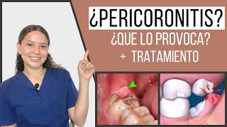 Pericoronitis  Pericoronaritis  Qué es y tratamiento  Odontología Con Cri [upl. by Caine701]