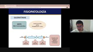 Epidermolisis bullosa [upl. by Nalra]