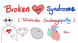 Broken Heart 💔 Syndrome Takotsubo cardiomyopathy  Cardiology Series [upl. by Arrik]