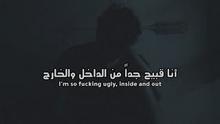 Timmies  Ugly Lyrics مترجمة [upl. by Ailb]