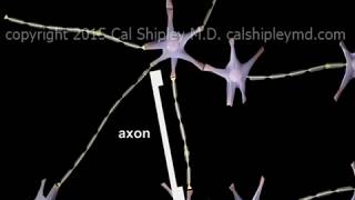 Traumatic Brain Injury  Diffuse Axonal Injury DAI  Animation by Dr Cal Shipley MD [upl. by Neerod]