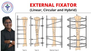 External Fixator  Lecture 07  Orthopedics [upl. by Heigho159]