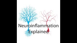 Neuroinflammation Explained [upl. by Maon]