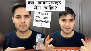 क्या आपको FINASTERIDE लेना चाहिए Finasteride Side effectsHindi Before and After Results Tablet [upl. by Yffat327]