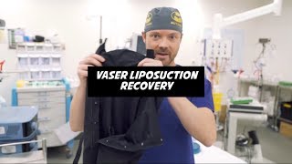 Vaser Liposuction Recovery [upl. by Lilac739]