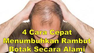 4 Cara Cepat Menumbuhkan Rambut Botak Secara Alami [upl. by Anitsyrc788]