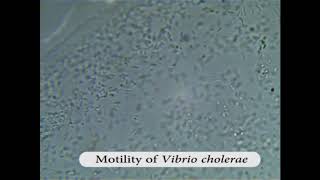 Motility of Vibrio cholerae [upl. by Chenee]