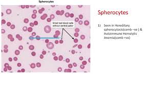 Hematology slides  HIGH YIELD TOPIC USMLE [upl. by Cinimod]