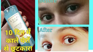 Khadi Under Eye Gel Review  Best Eye Cream [upl. by Roth]