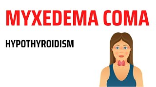 Myxedema Coma  Hypothyroidism [upl. by Notyalk]