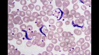 Trypanosoma cruzi PIA microbiologia UANL [upl. by Stoffel]