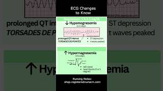 ECG Changes to Know in Electrolyte Imbalances  EKG Interpretation Nursing shorts [upl. by Fee]