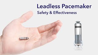 Cardiac Treatment Leadless Pacemakers [upl. by Wulfe]