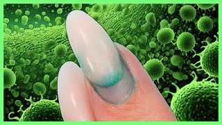 Watch For Hidden BacteriaGreenies In Your Nails [upl. by Odelinda]