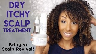 Dry Itchy Scalp Treatment Briogeo Scalp Revival Review  BiancaReneeToday [upl. by Ferna]