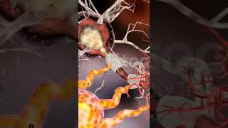 Nervous system  neuroglia  medical  trend video viral short  views [upl. by Jenny65]