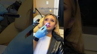 Getting my nose job splints out😳 gross but funny throwback😂 cosmetic nose crazy [upl. by Sophi]