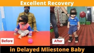 very good recovery in delayed milestone child delayed milestone [upl. by Sinegra120]