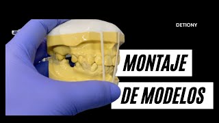 Como Montar MODELOS en articulador de bisagra Actualizado [upl. by Kondon]