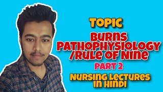 Burns  Pathophysiology  Rule of Nine in Burns Hindi  Nursing Lecture in Hindi MSN Part 2 [upl. by Weed]